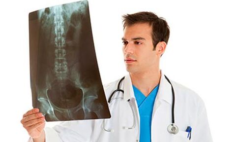 o doutor mira unha radiografía para diagnosticar a dor lumbar
